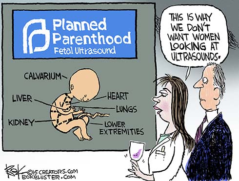 150716-planned-parenthood-parts-is-parts